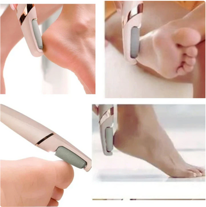 Eliminador de Callos Eléctrico Recargable - SOFTFEET PRO™
